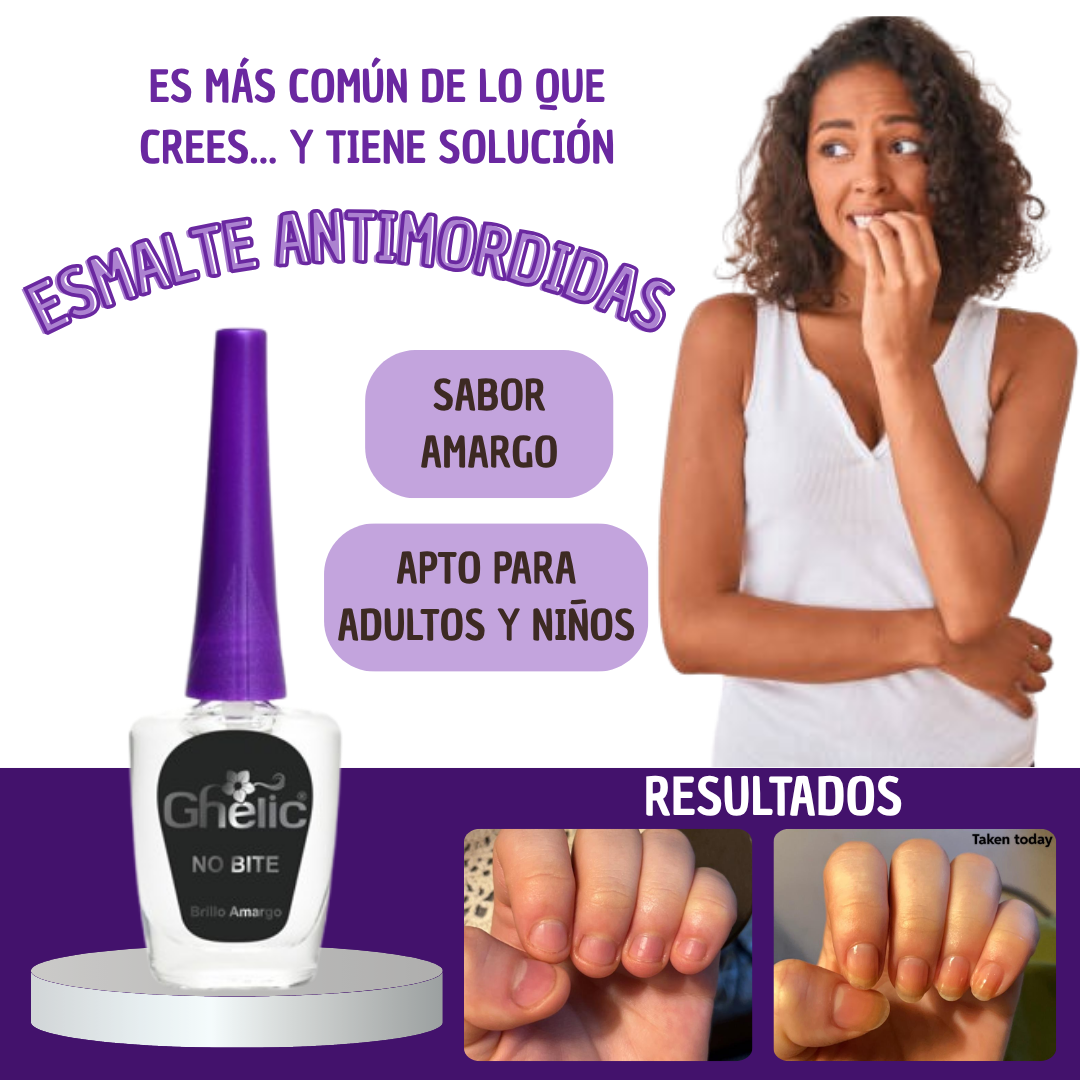 Tratamiento para NO comerse las uñas