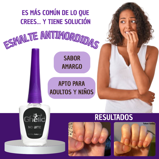 Tratamiento para NO comerse las uñas